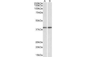 ABIN2562862 (0. (GNAQ antibody  (AA 162-175))