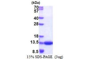 SDS-PAGE (SDS) image for CDC28 Protein Kinase Regulatory Subunit 1B (CKS1B) (AA 1-79) protein (His tag) (ABIN5853482)