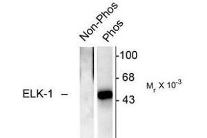 Image no. 2 for anti-ELK1, Member of ETS Oncogene Family (ELK1) (pSer383) antibody (ABIN221173) (ELK1 antibody  (pSer383))