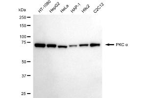 Western blotting analysis using PKC alpha antibody (ABIN7799991).