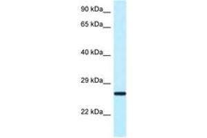 Image no. 1 for anti-Nudix (Nucleoside Diphosphate Linked Moiety X)-Type Motif 16 (NUDT16) (AA 45-94) antibody (ABIN6748090) (NUDT16 antibody  (AA 45-94))