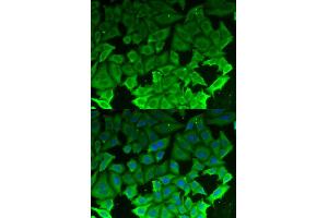 Immunofluorescence (IF) image for anti-Eukaryotic Elongation Factor-2 Kinase (EEF2K) antibody (ABIN1876592) (EEF2K antibody)