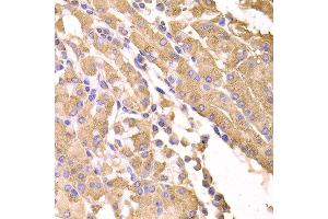 Immunohistochemistry of paraffin-embedded human stomach using SUFU antibody at dilution of 1:100 (x400 lens). (SUFUH antibody)