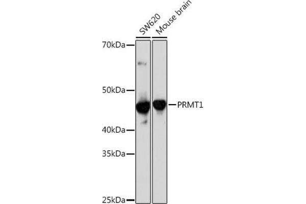 PRMT1 antibody