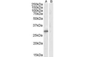 Image no. 1 for anti-E3 Ubiquitin-Protein Ligase SIAH1 (SIAH1) (N-Term) antibody (ABIN374155) (SIAH1 antibody  (N-Term))