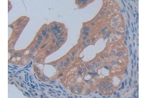 Detection of PFKP in Mouse Ovary Tissue using Polyclonal Antibody to Phosphofructokinase, Platelet (PFKP) (PFKP antibody  (AA 247-473))