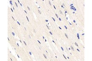 Immunohistochemistry analysis of paraffin-embedded rat heart using HES2 Polyclonal Antibody at dilution of 1:200. (HES2 antibody)