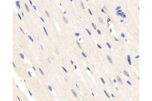 Immunohistochemistry analysis of paraffin-embedded rat heart using HES2 Polyclonal Antibody at dilution of 1:200. (HES2 antibody)