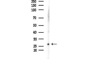 Western blot analysis of lysates from A375 cells(heat-shock,45 min treatment), using LAT Antibody at 1/1000 dilution.