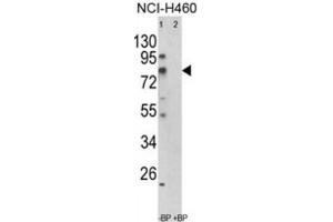 Western Blotting (WB) image for anti-Acyl-CoA Synthetase Short-Chain Family Member 3 (ACSS3) antibody (ABIN3003813)