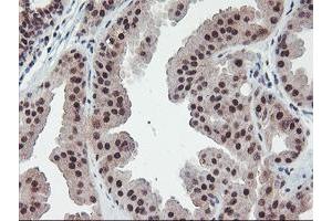 Immunohistochemical staining of paraffin-embedded Human breast tissue using anti-POLR2E mouse monoclonal antibody.
