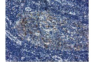 Immunohistochemical staining of paraffin-embedded Human lymph node tissue using anti-LIN7B mouse monoclonal antibody. (LIN7B antibody)