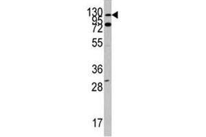 Western Blotting (WB) image for anti-C-Abl Oncogene 1, Non-Receptor tyrosine Kinase (ABL1) (AA 231-260) antibody (ABIN3030215)