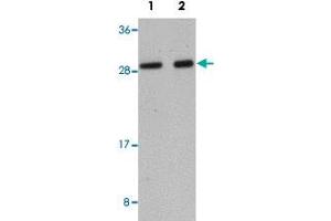Western blot analysis of human liver tissue with LYRM1 polyclonal antibody  at (Lane 1) 1 and (Lane 2) 2 ug/mL dilution. (LYRM1 antibody  (Internal Region))