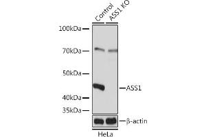 Western blot analysis of extracts from normal (control) and  Rabbit pAb knockout (KO) HeLa cells, using  Rabbit pAb antibody (ABIN7265667) at 1:3000 dilution. (ASS1 antibody  (AA 1-412))