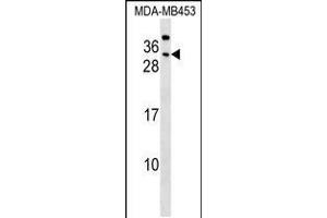 Western blot analysis in MDA-MB453 cell line lysates (35ug/lane). (CEACAM7 antibody  (AA 112-140))