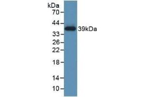 Detection of Recombinant TBG, Human using Polyclonal Antibody to Thyroxine Binding Globulin (TBG) (SERPINA7 antibody  (AA 128-415))