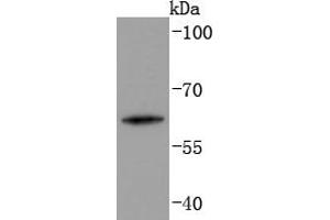 Human skin lysates probed with Cytokeratin 2e (2F7) Monoclonal Antibody  at 1:1000 overnight at 4˚C. (Keratin 2 antibody)