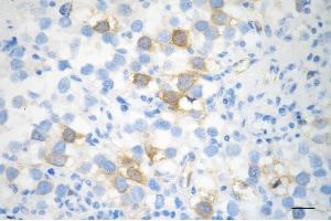 anti-Pituitary Tumor-Transforming 1 (PTTG1) antibody