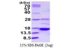 Image no. 1 for A Kinase (PRKA) Anchor Protein 7 (AKAP7) protein (His tag) (ABIN1098273) (AKAP7 Protein (His tag))