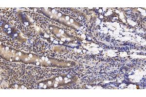 Immunohistochemistry (IHC) image for anti-Interferon, beta 1, Fibroblast (IFNB1) antibody (ABIN7425770)