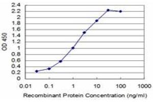 Detection limit for recombinant GST tagged T is approximately 0. (T Brachyury Protein (AA 222-320) antibody)