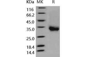 Western Blotting (WB) image for Fc Fragment of IgG, Low Affinity IIa, Receptor (CD32) (FCGR2A) (Active) protein (Biotin,His-Avi Tag) (ABIN7317026) (FCGR2A Protein (Biotin,His-Avi Tag))