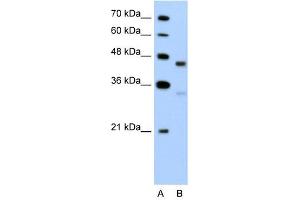 GPR161 antibody used at 5 ug/ml to detect target protein. (GPR161 antibody  (C-Term))
