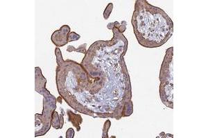 Immunohistochemical staining of human placenta with PROX2 polyclonal antibody  shows strong membranous and cytoplasmic positivity in trophoblastic cells at 1:200-1:500 dilution. (PROX2 antibody)
