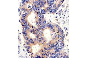 Immunohistochemical analysis of paraffin-embedded H. (PCSK9 antibody  (C-Term))