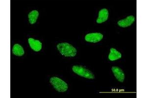 Image no. 2 for anti-Transcription Factor 7 (T-Cell Specific, HMG-Box) (TCF7) (AA 287-385) antibody (ABIN598962) (TCF7 antibody  (AA 287-385))