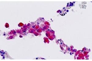 Human, Lung, Macrophages: Formalin-Fixed Paraffin-Embedded (FFPE) (FFAR2 antibody  (AA 286-315))