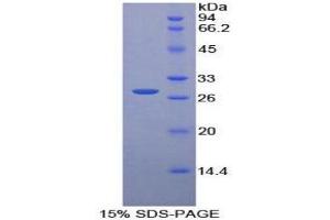 SDS-PAGE (SDS) image for Pyridoxal Kinase (PDXK) (AA 35-251) protein (His tag) (ABIN2126584) (PDXK Protein (AA 35-251) (His tag))