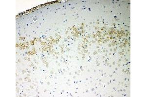 IHC-P: VE-Cadherin antibody testing of rat brain tissue (Cadherin 5 antibody  (AA 766-784))