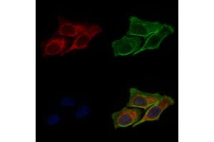 ABIN6264550 and ABIN6277788 staining Hela cells by IF/ICC. (RAB10 antibody  (C-Term))