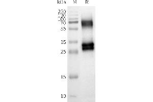 Western Blotting (WB) image for Olfactory Receptor, Family 8, Subfamily U, Member 8 (OR8U8) protein (ABIN7538453)