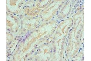Immunohistochemistry of paraffin-embedded human kidney tissue using ABIN7168895 at dilution of 1:100 (SPTLC1 antibody  (AA 37-310))