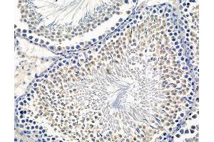 ABIN7096598 and ABIN7100662 at 1/100 staining rat testis tissue by IHC-P.