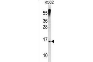 Western Blotting (WB) image for anti-MAX Dimerization Protein 3 (MXD3) antibody (ABIN2998538) (MXD3 antibody)