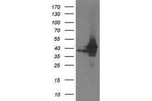 HEK293T cells were transfected with the pCMV6-ENTRY control (Left lane) or pCMV6-ENTRY ATG3 (Right lane) cDNA for 48 hrs and lysed. (ATG3 antibody)