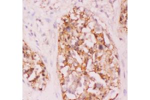 Immunohistochemistry (IHC) image for anti-V-Crk Sarcoma Virus CT10 Oncogene Homolog (Avian) (CRK) (AA 2-246) antibody (ABIN3042758)