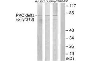 Western blot analysis of extracts from HepG2 cells, COLO205 cells and HuvEc cells, using PKC delta (Phospho-Tyr313) Antibody. (PKC delta antibody  (pTyr313))