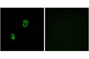 Immunofluorescence analysis of A549 cells, using CCR7 Antibody. (CCR7 antibody  (AA 170-219))