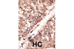 Immunohistochemistry (IHC) image for anti-Bone Morphogenetic Protein 3 (BMP3) antibody (ABIN2999248)