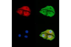 ABIN6259253 and ABIN6275428 staining Hela cells by IF/ICC. (PDXDC1 antibody  (C-Term))