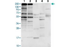 Western blot analysis of Lane 1: RT-4, Lane 2: U-251 MG, Lane 3: Human Plasma, Lane 4: Liver, Lane 5: Tonsil with ZNF646 polyclonal antibody  at 1:250-1:500 dilution.