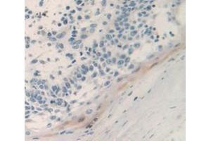 IHC-P analysis of Human Tissue, with DAB staining. (PSCA antibody  (AA 22-95))