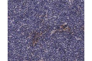 ABIN6267620 at 1/200 staining human lymph nodes tissue sections by IHC-P. (Caldesmon antibody  (pSer789))