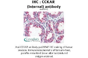 Image no. 2 for anti-Cholecystokinin A Receptor (CCKAR) (Internal Region) antibody (ABIN1732731) (CCKAR antibody  (Internal Region))