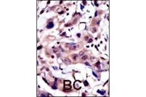 Immunohistochemistry (Paraffin-embedded Sections) (IHC (p)) image for anti-Muscle, Skeletal, Receptor Tyrosine Kinase (MUSK) (AA 35-65), (N-Term) antibody (ABIN392019)